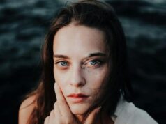 Vitiligine, arriva in Italia il primo trattamento specifico