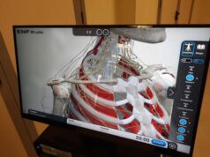 Dolore in Reumatologia: un’apparecchiatura di ultima generazione donata al Policlinico dal Pettirosso