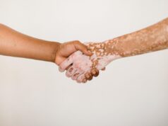 Malattie della pelle, Salutequità “Più programmazione e reti dedicate”