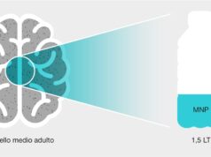 Nel cervello umano l’equivalente di 1/3 di una bottiglia di plastica