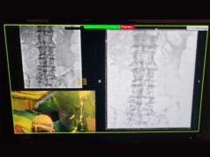 Un innovativo sistema per la gestione delle immagini è ora in dotazione alla Sala Ibrida del CORE