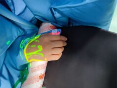 Policlinico di Modena: un rilevatore di vene per le sale operatorie pediatriche