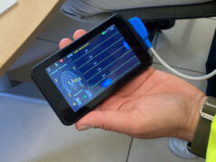 Un elettrocardiografo portatile per le ebike 118 donato dal Rotary Club Bologna Valle del Savena