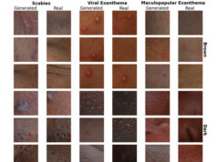 Verso un’IA più equa: dall’Università di Bologna una tecnologia per una diagnosi dermatologica inclusiva