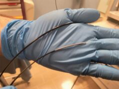 Minisonde per la diagnosi del tumore al polmone donate al Santa Maria Bianca da ‘La Nostra Mirandola’