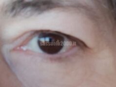 Settimana Mondiale del Glaucoma: l’UICI di Reggio Emilia scende in campo per la prevenzione